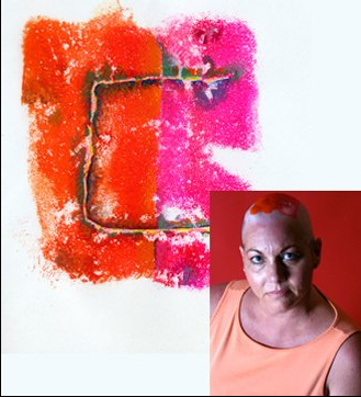 "Stage Four Brain Cancer" by Ted Meyer